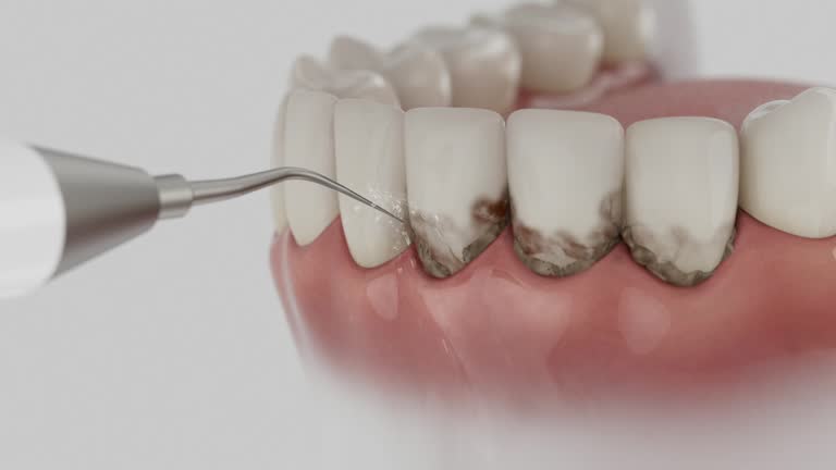 Reliable Dental contractor in Cherryland, CA by Smile Center Dentistry